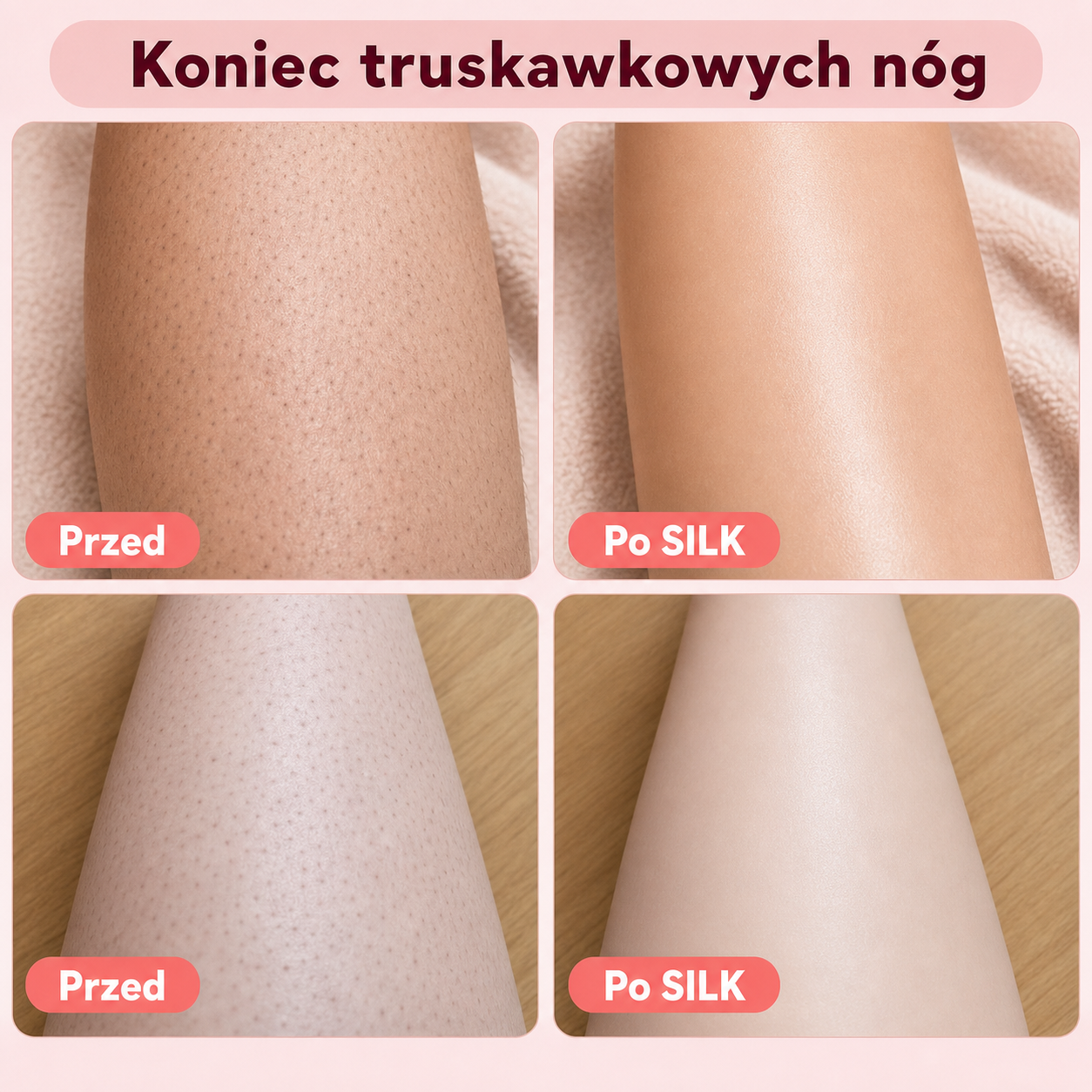 Koniec truskawkowych nóg